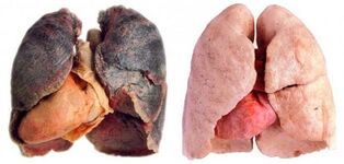 Fumatori polmoni e sani
